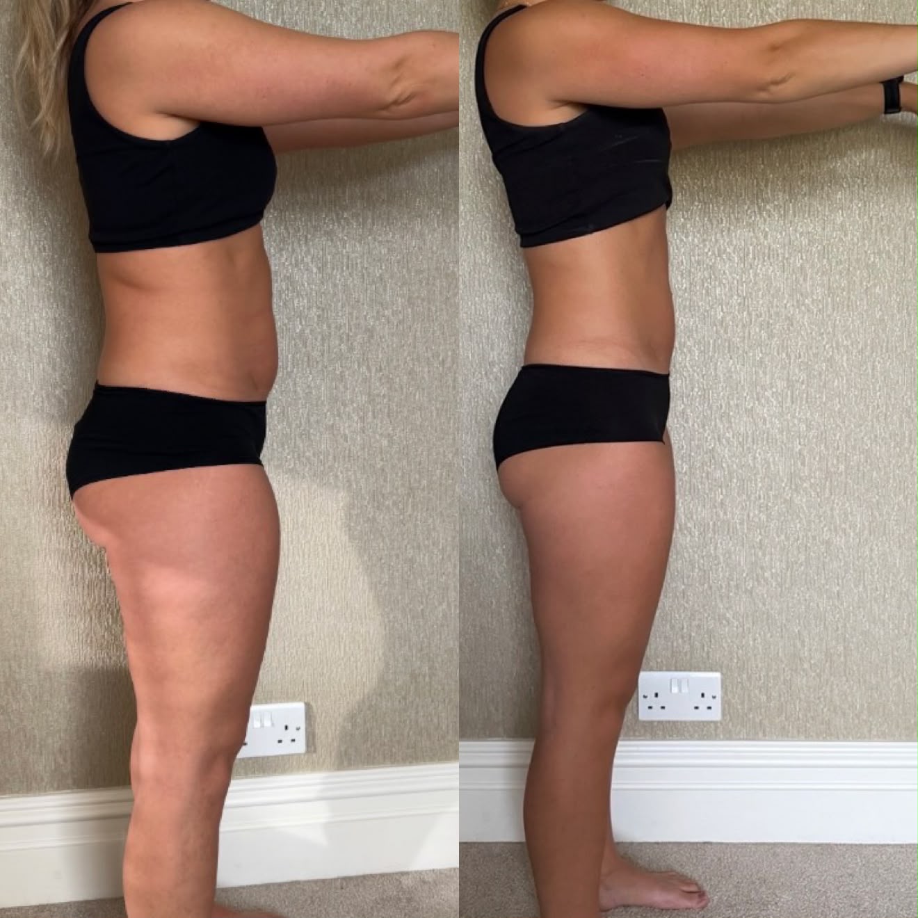 Plantfit member transformation